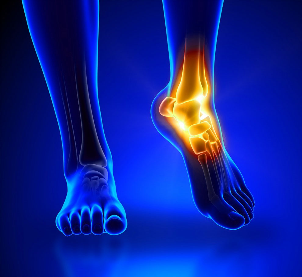 Understanding and Preventing Tendonitis